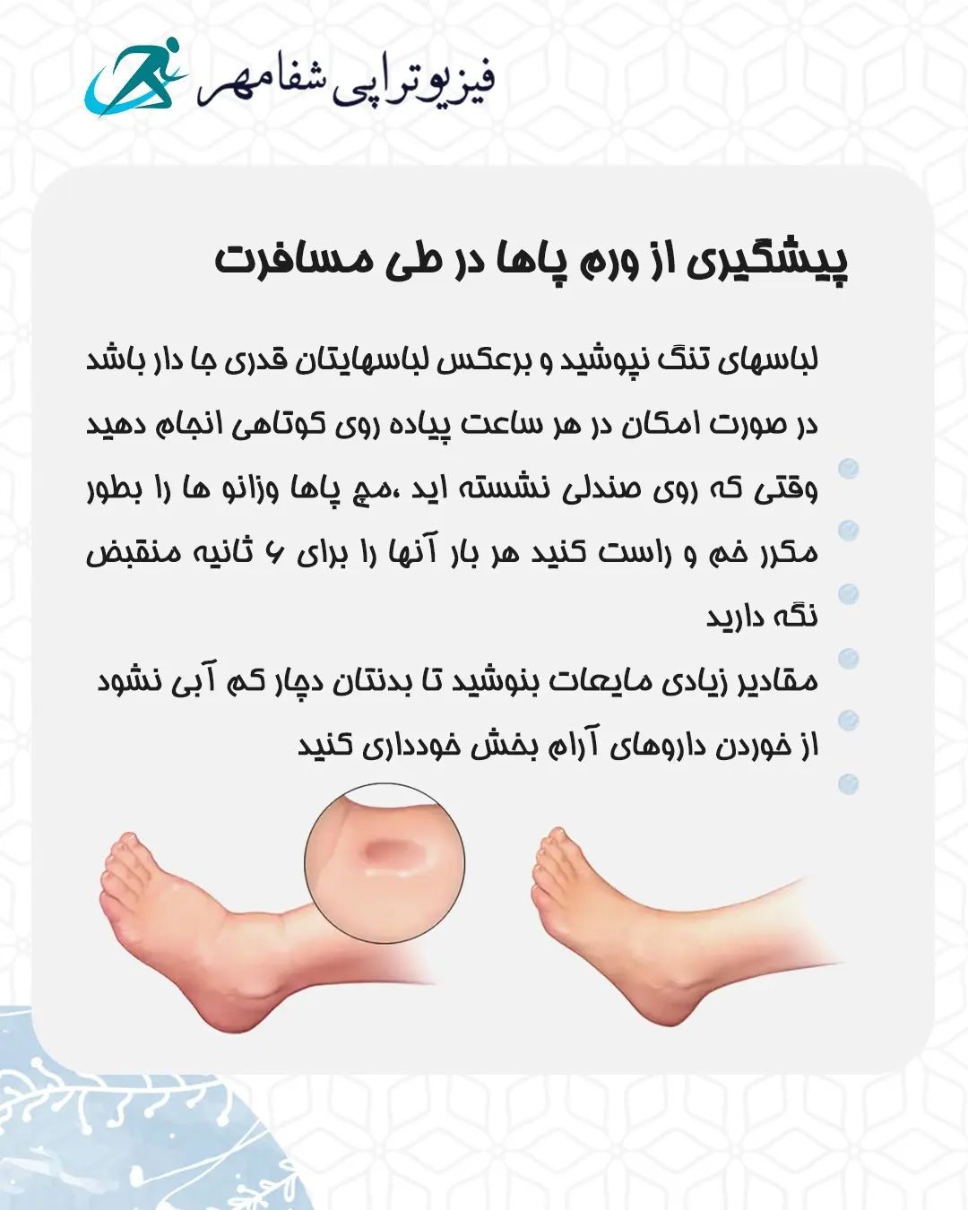 جلوگیری از ورم پا در مسافرت