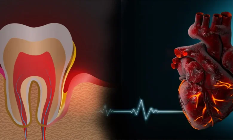 آیا عفونت دندان باعث آسیب به قلب می شود؟