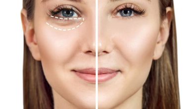 شش راه حل برای از بین بردن پف و تیرگی زیر چشم
