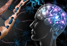تعداد بیماران مبتلا به ام اس در استان اصفهان در سه دهه گذشته بیش از ۲۵۰ برابر شده