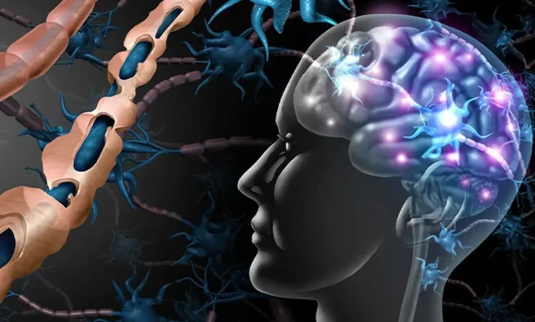 تعداد بیماران مبتلا به ام اس در استان اصفهان در سه دهه گذشته بیش از ۲۵۰ برابر شده