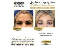 ویدیو لیفت آندوسکوپیک صورت و گردن توسط دکتر مجید نداف کرمانی