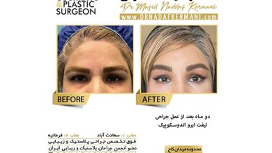 ویدیو لیفت آندوسکوپیک صورت و گردن توسط دکتر مجید نداف کرمانی