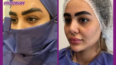لیفت دائمی ابرو