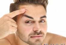 ویدیو جراحی لیفت پیشانی و بینی مردانه به صورت همزمان