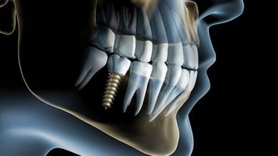 رادیولوژی فک و صورت؛ کاربردها و روش‌های تصویربرداری