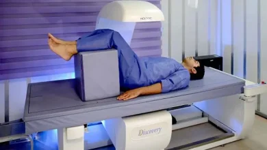 سنجش تراکم استخوان چقدر هزینه دارد و چه عواملی روی قیمت آن اثر می‌گذارد؟