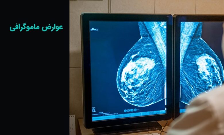 عوارض ماموگرافی چیست و نحوه کاهش آن