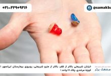 انواع سمعک نامرئی و راهنمای خرید سمعک مناسب