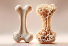 راهی جدید برای ترمیم پوکی استخوان