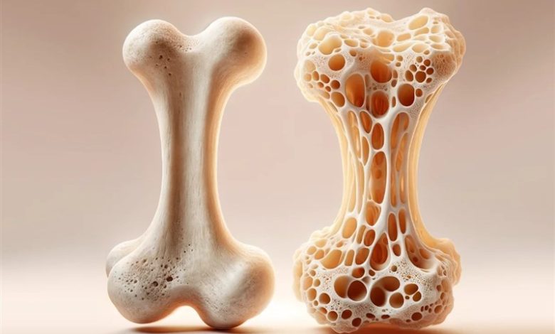 راهی جدید برای ترمیم پوکی استخوان