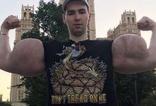 ملوان زبل روسی در آستانه قطع هر دو دست