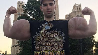 ملوان زبل روسی در آستانه قطع هر دو دست