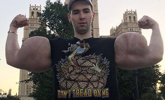 ملوان زبل روسی در آستانه قطع هر دو دست