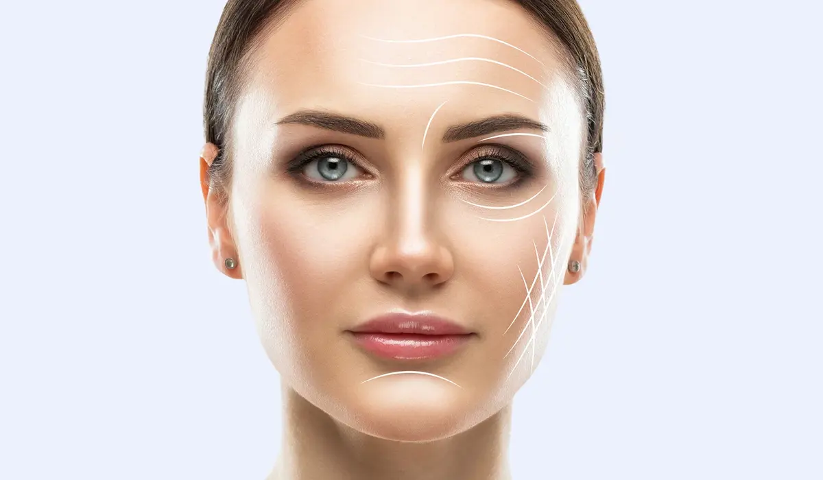 مراحل انجام لیپوفیس (قبل، حین و بعد از عمل)