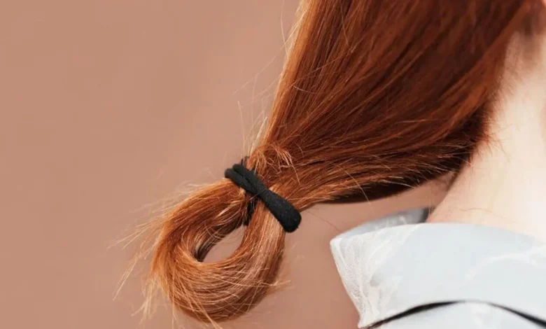 3 نکته برای جلوگیری از ریزش و موخوره مو در زمستان