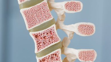 تغییرات خاموش در مغز استخوان می تواند علائم اولیه سرطان خون باشد