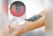 برچسب عرق کره جنوبی قند خون را بدون هیچ سوزنی کنترل می کند