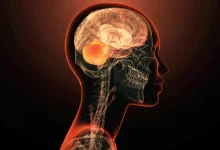 کشف ژنی که به تنهایی عامل بیماری های روانی است